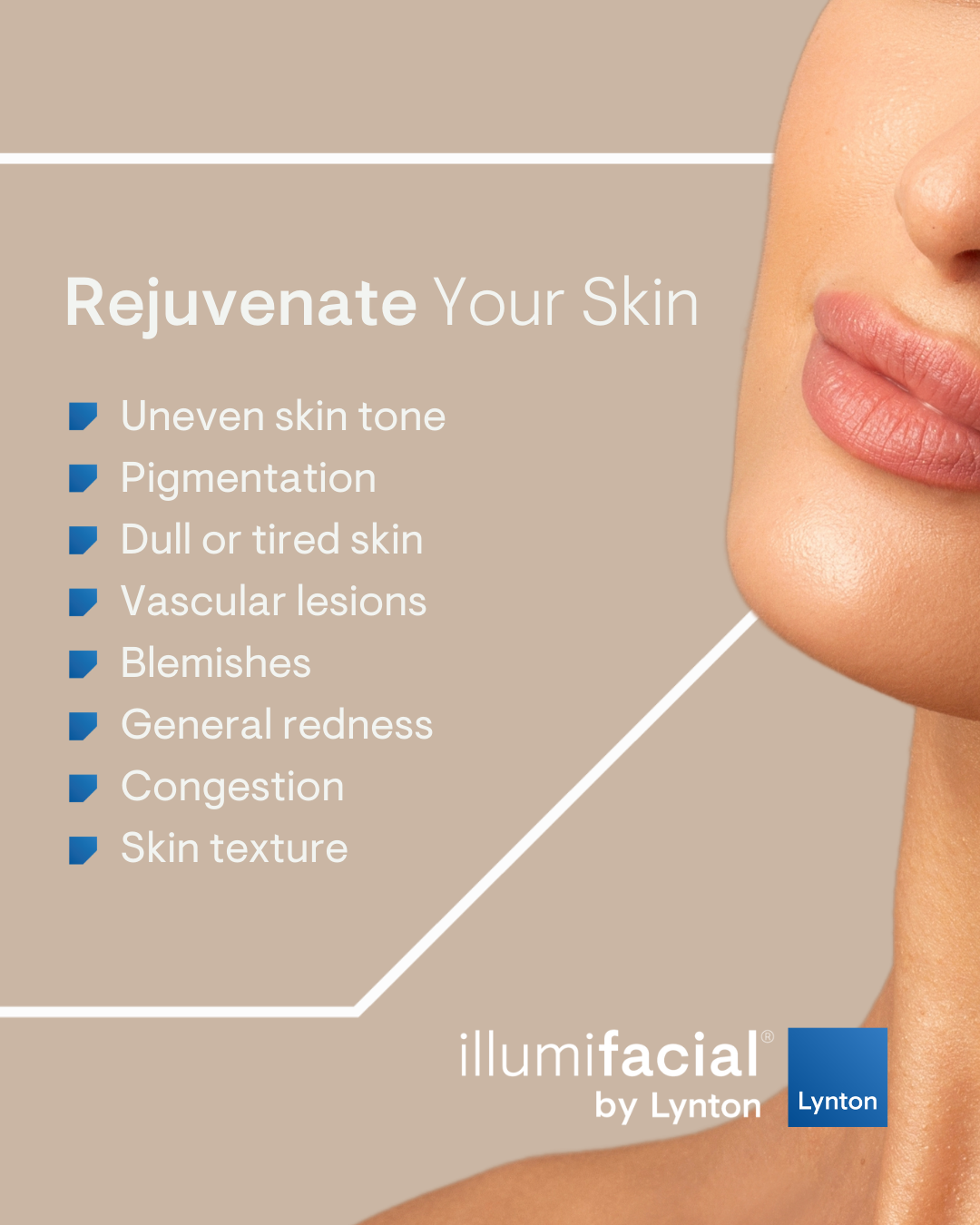 IllumiFacial® b2c social posts (1080 x 1350 px)